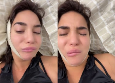 VIDEO | La influencer Luciana Milessi fue agredida en las redes sociales por las secuelas de una cirugía