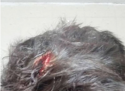 La Plata: Lo atacaron entre cuatro y le abrieron la cabeza, aún no hay detenidos