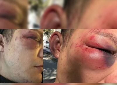 "Lo dejaron al borde de la muerte": salvaje golpiza en manada a un joven en un boliche de La Plata y las cámaras "misteriosamente" no grabaron nada