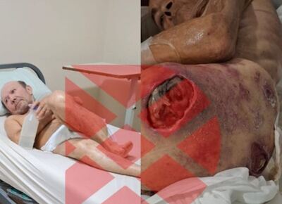 Escándalo nacional: abuelos cagados, meados y llenos de hormigas en una clínica de La Plata
