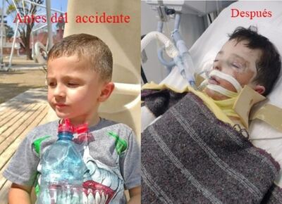 La Plata: Thiago, el nene de 7 años que sobrevivió a un choque causado por un conductor alcoholizado y drogado, necesita ayuda para seguir con su tratamiento