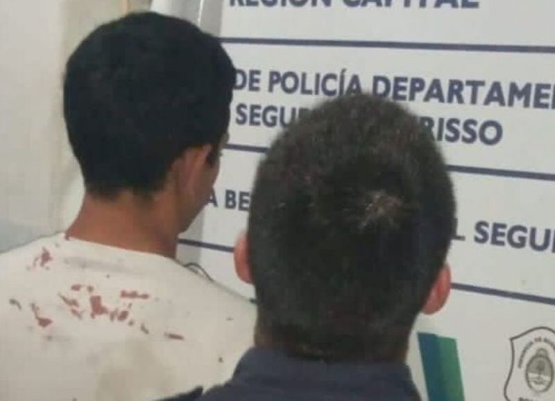 Maltrato infantil en Berisso: quemaban a sus hijos con leche hirviendo