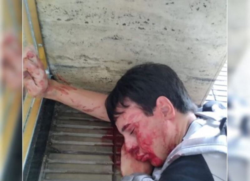 Delincuencia al rojo vivo en La Plata: se dirigía a la UNLP a rendir un parcial, dos ladrones lo interceptaron para robarle y le dieron una brutal golpiza
