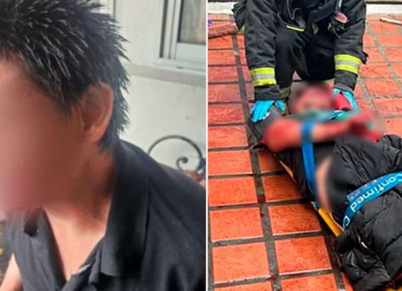 Violenta pelea entre vecinos en La Plata: se enfrentaron a cuchillazos y terminaron con el rostro desfigurado