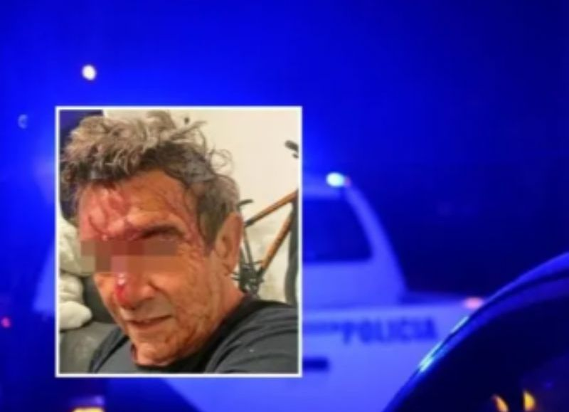 Brutal entradera en City Bell: golpearon y balearon a un hombre, los vecinos afirman que ya no soportan más la inseguridad